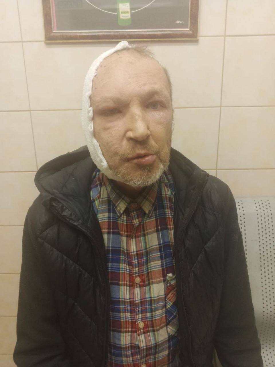 «Оправдать доверие». Это сейчас у Андрея Колегова проходят отёки на лице «Оправдать доверие». Это сейчас у Андрея Колегова проходят отёки на лице